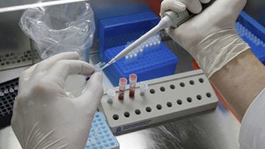 americateve | Actualmente el medicamento se encuentra en ensayo clínico.