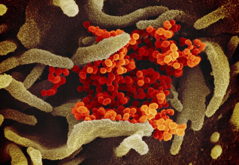 AMN-MED_CORONAVIRUS-NUEVA_PRUEBA-0.jpg