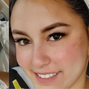 Joven cubana presenta mejoría tras grave enfermedad cardíaca en Estados Unidos