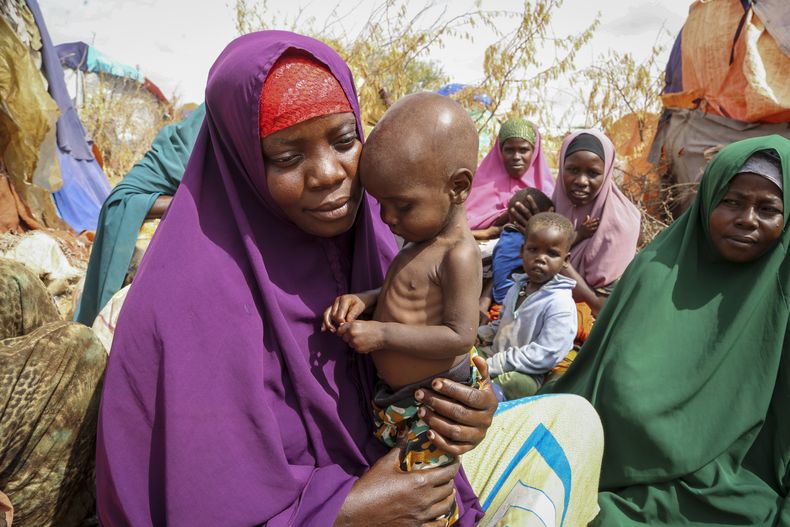 Nunay Mohamed, de 25 años, que huyó de la sequía en la región de Shabelle Inferior, sostiene a su niño desnutrido de un año en un campamento para desplazados en las afueras de Mogadiscio, Somalia, 30 de junio de 2022. (AP Foto/Farah Abdi Warsameh, File)