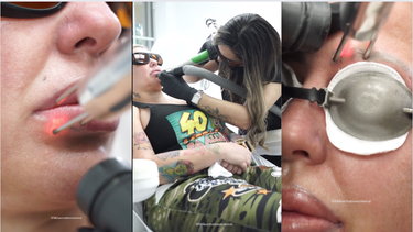 la diosa comienza proceso de eliminacion de los tatuajes de cejas y lip liner