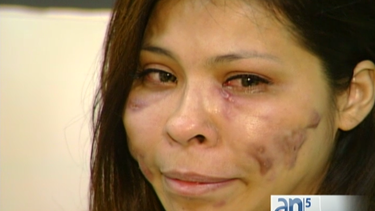 americateve | mujer cara  deformada