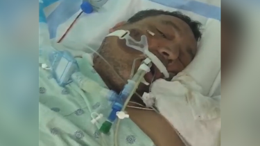 americateve | HOMBRE EN COMA.png