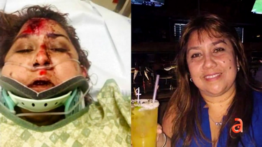 madre colombiana de miami gravemente herida tras ser atropellada