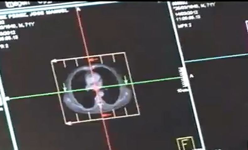 Este tipo de cáncer se cobra cada año muchas vidas.