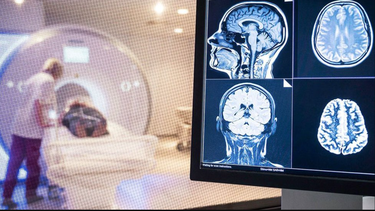 ¿cual es el efecto cognitivo del covid? el cerebro de algunos pacientes podria envejecer hasta 10 anos