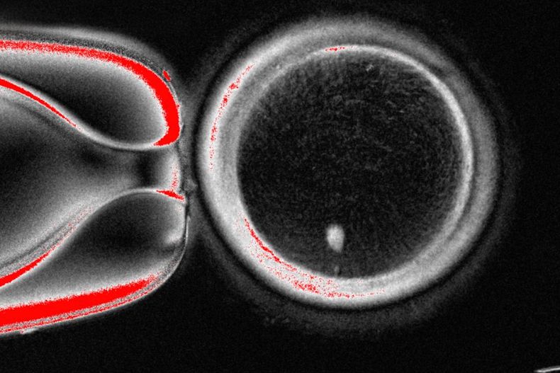 Foto sin fecha, suministrada por el Laboratorio Mitalipov Laboratory en la Universidad de Salud y Ciencia de Oregon, que muestra una imagen microscópica de un óvulo humano que contiene un núcleo tomado de una célula de piel. (Laboratorio Mitalipov via AP)