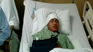 americateve | Se recupera un joven ciclista que fue arrollado en Homestead este domingo.