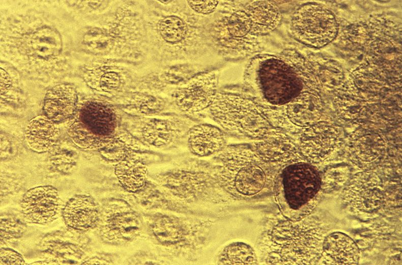 ARCHIVO – En esta imagen de microscopio de 1975, puesta a disposición por los Centros para el Control y la Prevención de Enfermedades, se muestra la bacteria Chlamydia trachomatis. (Dr. E. Arum, Dr. N. Jacobs/CDC vía AP)