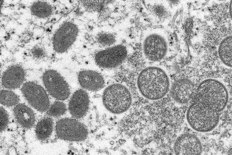 Más de 200 casos de viruela símica en el mundo, dice la OMS