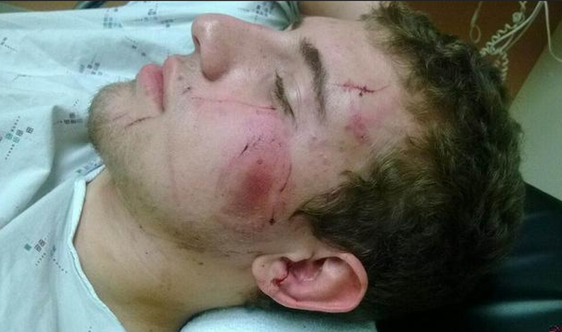 Un hombre desnudo y con una inusual fuerza física atacó a varias personas en el condado Palm Beach.