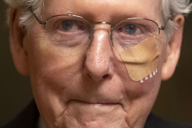 El líder de los republicanos en el Senado, Mitch McConnell, con una venda en la cara mientras camina hacia una votación en el Senado, el 10 de diciembre del 2024, en Washington. (AP foto/Mark Schiefelbein)