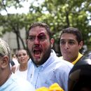 Venezuela: congresista resulta herido en protesta
