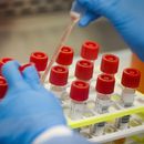 Pasos en falso demoran respuesta de EEUU al coronavirus