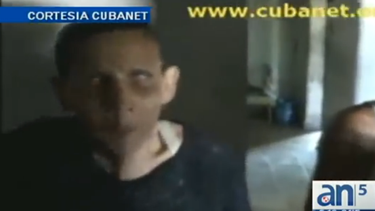 americateve | Una mujer cubana ciega dice que tiene que prostituirse para poder sobrevivir en Cuba.