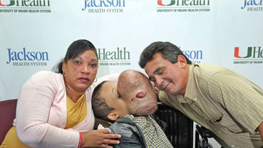 ¡doloroso final! fallecio el nino cubano operado en miami de un gigantesco tumor