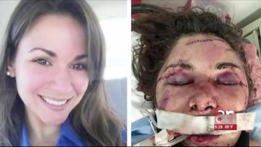 comienza el juicio contra hombre que ataco brutalmente a su companera de casa