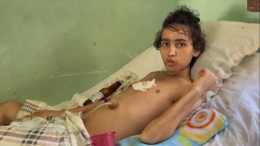 fallece yordanis nieves mendez, joven cubano de 19 anos tras dos anos de sufrimiento