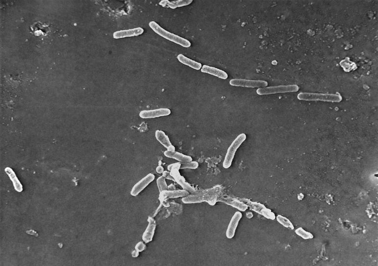 Superbacterias causan más de 1,2 millones de muertes