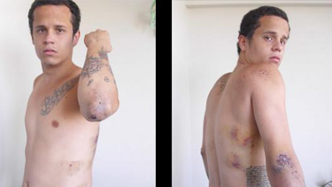 Brutal represión: "Me metieron por el ano el cañón del fusil"