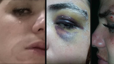 denuncian acoso sexual y agresion contra joven actriz cubana en camagüey