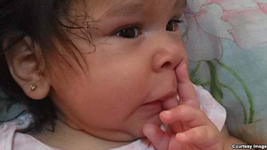 se agrava la salud de maya ledesma fabelo la nina cubana de 9 meses que sufre una enfermedad cronic