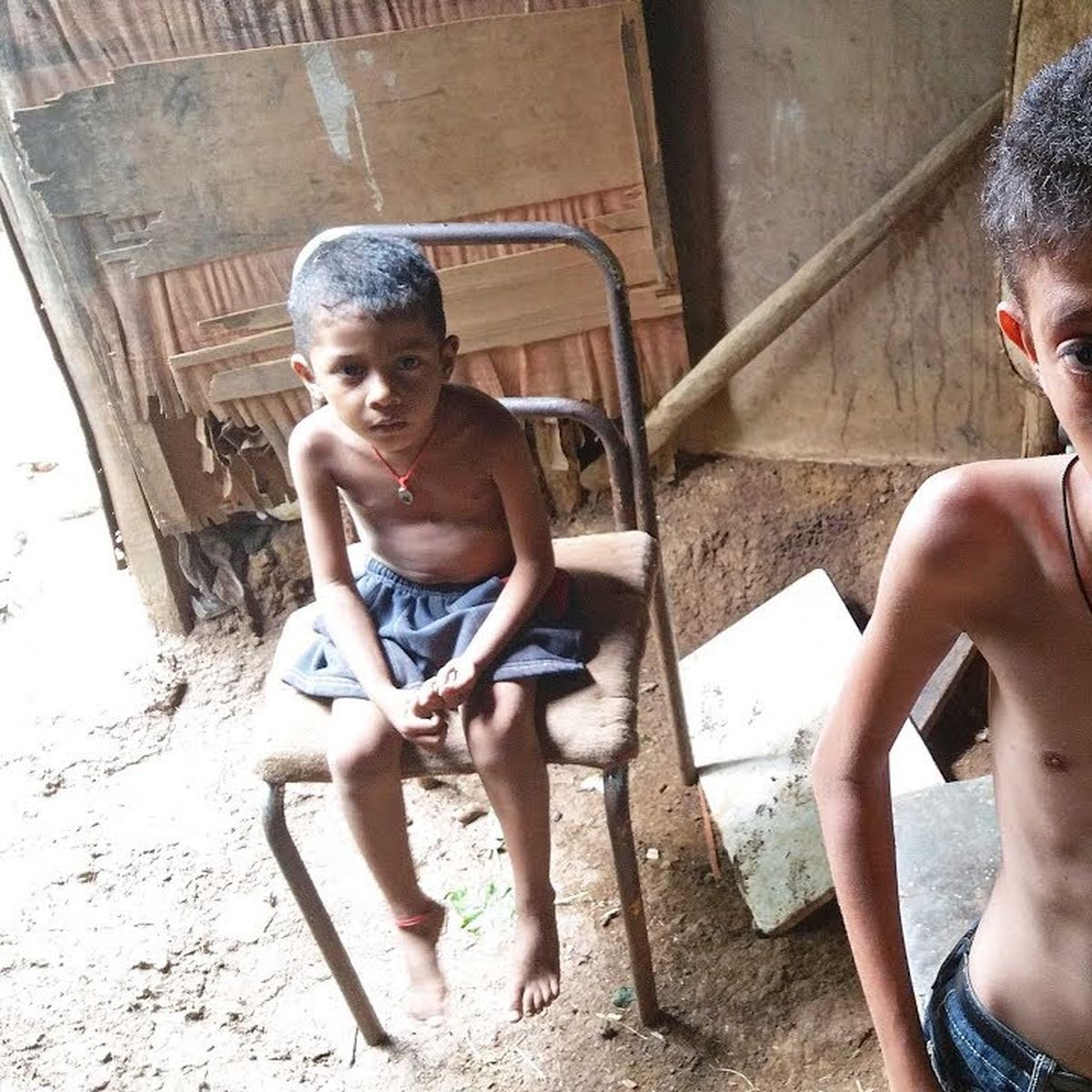 Imagenes Niños De Africa En Desnutricion Adultos y niños puntean cifras de desnutrición en Venezuela