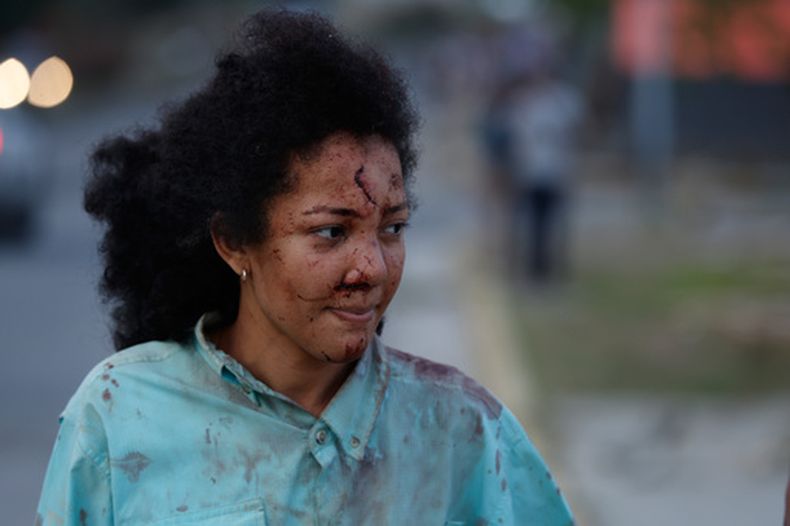 Una mujer herida camina por La Guaira, Venezuela, un día después de que un terremoto sacudiera la zona, el jueves 25 de junio de 2026. (Foto AP/Pedro Mattey)