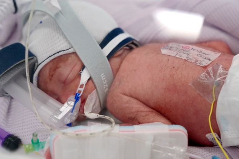 En esta imagen del 15 de julio de 2026, se puede ver a una de las cuatrillizas que nacieron en el hospital Metro North Health, en Brisbane, Australia. (Metro North Health via AP)