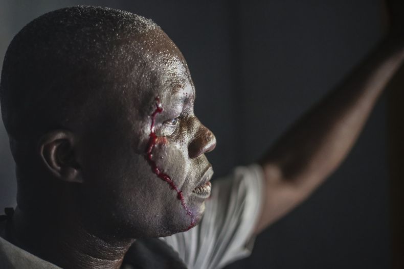 Un guardia de seguridad herido en un ataque a un hospital en Puerto Príncipe, Haití, el 24 de diciembre del 2024. (AP foto/Jean Feguens Regala)