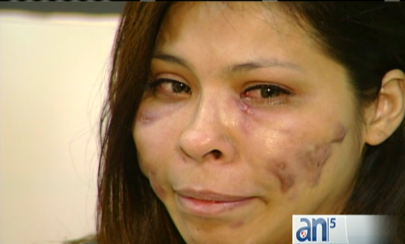 mujer cara  deformada