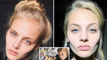 la modelo rusa ksenia puntus lucha por su vida tras caer desnuda desde una ventana de un tercer piso