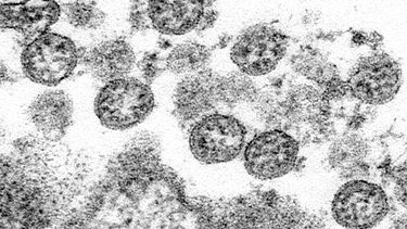 Estudio: Había COVID en EEUU antes de lo pensado