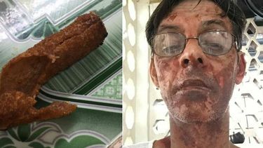 las croquetas explosivas se siguen cobrando victimas en cuba