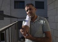 palestino denuncia haber sido golpeado por policia israeli