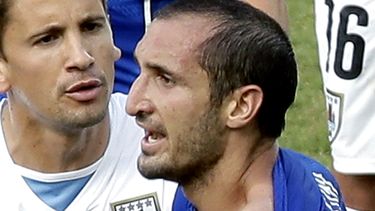 americateve | El italiano Giorgio Chiellini muestra el hombro donde dice que el uruguayo Luis Su&aacute;rez lo mordi&oacute; durante el encuentro entre Italia y Uruguay en la Copa del Mundo en Natal, Brasil, el 24 de junio de 2014. Chiellini opin&oacute; que la sanci&o