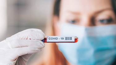 covid-19: estudios revelaron que tipo de sangre es mas susceptible de contraer un cuadro grave de la enfermedad
