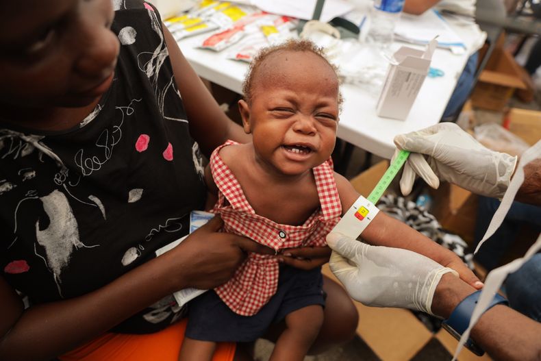 Un niño desnutrido es examinado por un médico de una farmacia itinerante en un refugio para familias desplazadas por la violencia en Puerto Príncipe, Haití, el martes 7 de octubre de 2025. (AP Foto/Patrice Noel)