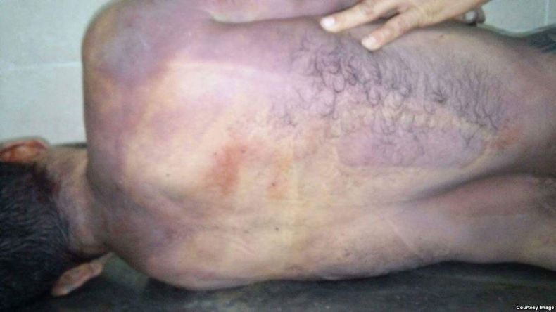 hombre muerto cuba III