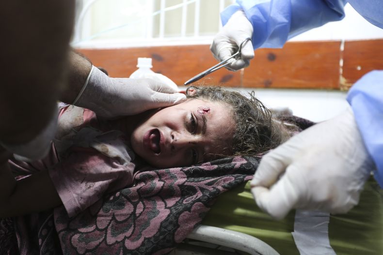 Una niña palestina herida en un ataque israelí sobre la Franja de Gaza recibe tratamiento en un hospital en Rafah, el 30 de octubre de 2023. (AP Foto/Hatem Ali)