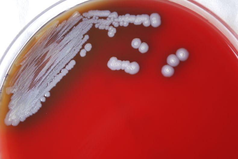 AMN-MED EEUU-MELIOIDOSIS