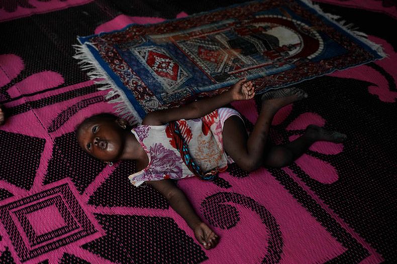 Farisa, que ha recaído en la malnutrición, juega en una alfombra en su casa en Kware Sokoto, en el noroeste de Nigeria, el miércoles 15 de julio de 2026. (AP Foto/Sunday Alamba)