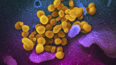 Células de coronavirus, indicadas en amarillo, saliendo de la superficie de células marcadas con azul y rosado, en esta foto de microscopio suministrada por los Institutos Nacionales de Salud de Estados Unidos, en febrero de 2020. (NIAID-RML via AP)