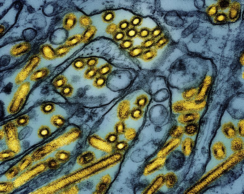 Esta imagen a color de un microscopio publicada por el Instituto Nacional de Enfermedades Alérgicas e Infecciosas de Estados Unidos el 26 de marzo de 2024, muestra partículas del virus de la influenza A H5N1 en amarillo. (CDC/NIAID vía AP)