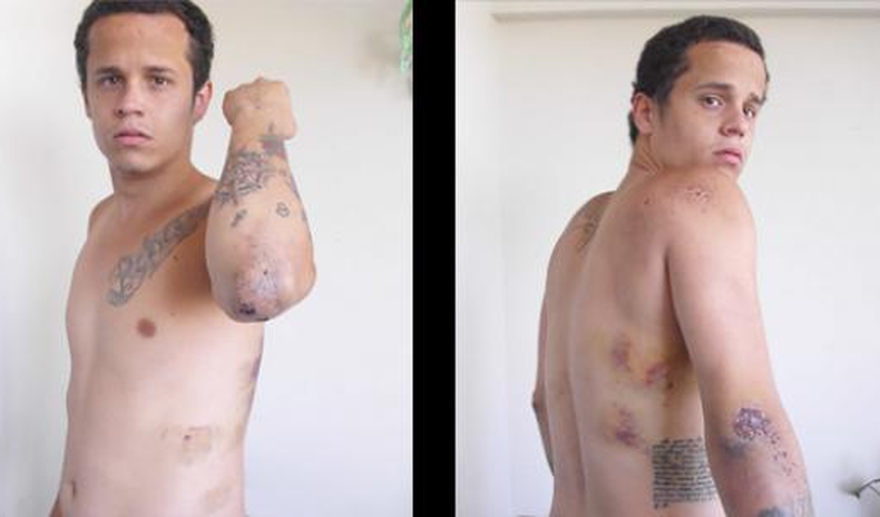 Juan Manuel Carrasco, de 21 años, relata la agonía, los golpes y vejaciones que recibió de la Guardia Nacional Bolivariana cuando fue detenido el 13 de febrero