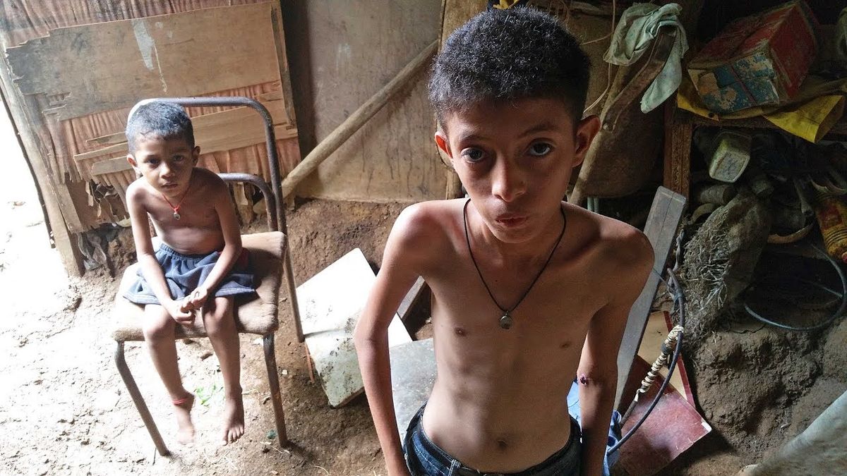 Imagenes Niños De Africa En Desnutricion Adultos y niños puntean cifras de desnutrición en Venezuela