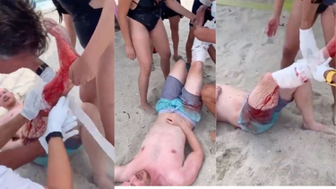 tiburon ataca a un banista en las playas de miami beach