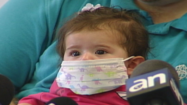 trasplantan corazon de bebe de 6 meses en miami