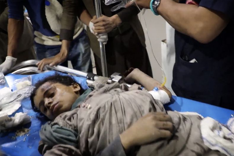 Foto tomada de video, difundido por la Oficina de Prensa Ansar Allah via el canal de televisión Al Masirah, que muestra a un niño herido en un hospital en hospital en Saada, Yemen, el 15 de marzo del 2025 tras ataques aéreos en el país. (Al Masirah TV via AP)