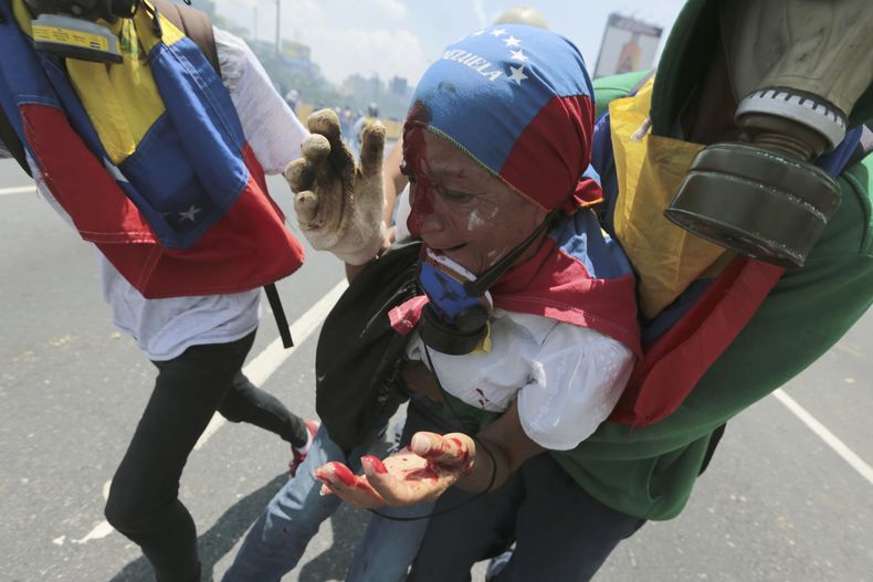 AMS-GEN_VENEZUELA-CRISIS_POLITICA-0.jpg
